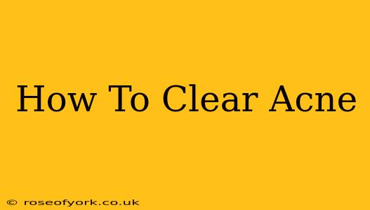 How To Clear Acne