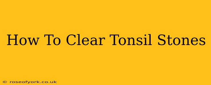 How To Clear Tonsil Stones