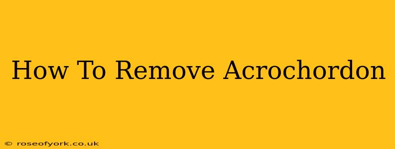 How To Remove Acrochordon