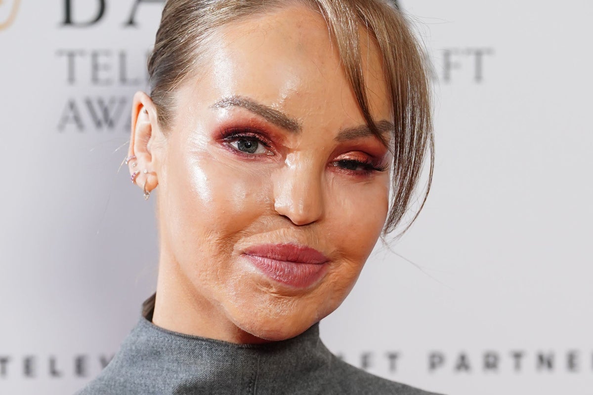 Unexpected Surgery Forces Katie Piper's Difficult Decision